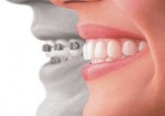 plano-odontologico-santos-1457989434