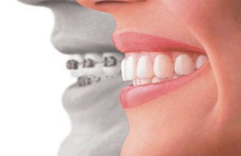 Odontobase Planos de Saúde Bucal - Foto 1