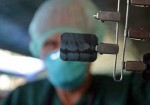 radiologia-odontologia-santos-1457990820