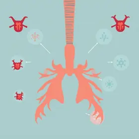 tuberculose